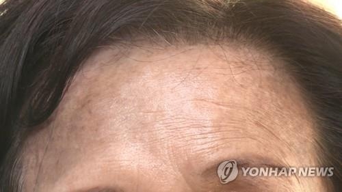 헤나 성분 염모제 5종 `미생물 기준치 초과`…"피부 착색 등 부작용"