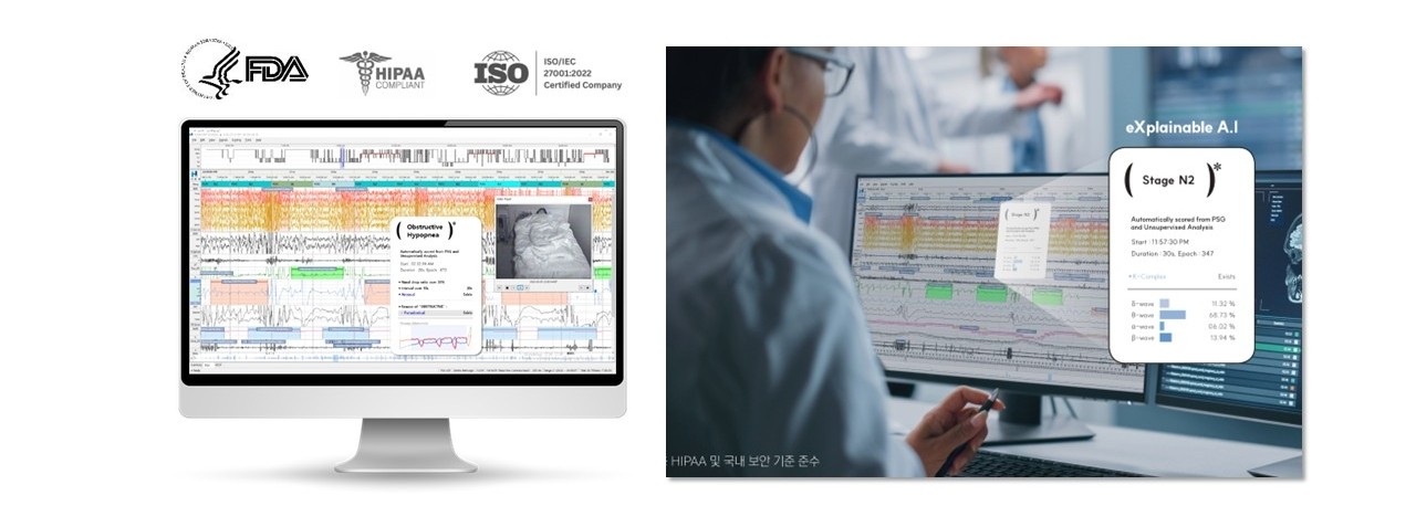 허니냅스, FDA 승인 AI '솜눔'으로 임상시험 파이프라인 단축 - 뉴스 썸네일 이미지
