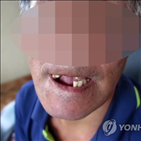 조사,장애인,지역