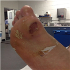 선수,정현,기권,경기