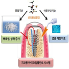 의료기기,이식형,수술기,임플란트,개발