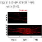 손상,신경,바이로메드,말초신경