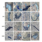 미세플라스틱,패류,의원,검출