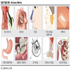 이식재,엘앤씨바이오,피부,확인,인체조직