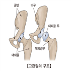 대퇴골,비만,아이,부분