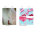 퇴행성관절염,콜레스테롤,연골