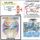 퇴행성관절염,노화,연골,치료법,연골조직,증가