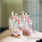 부항,치료,한의사,의료행위