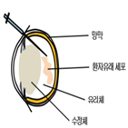 뇌암,동물모델,안구,난치성,주사