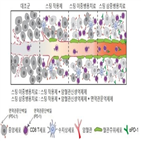 스팅,단백질,혈관,종양,면역세포