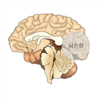 치매,환자,알츠하이머,기억장애