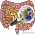 대장암,연구팀,박테리아