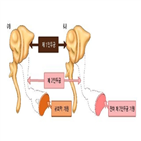 기형,이소골,수술,등골