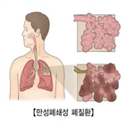 염증,환자,치료제,진행