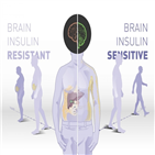 인슐린,체중,지방,민감성,내장지방