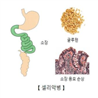 악병,화학물질,수치,독성,청소년,혈중