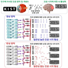 인공망막,세포,망막,변성,신경절,성능,진행