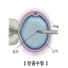 배아,이식,신선,임신