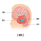 칸나비디올,부위,연구팀,대마초