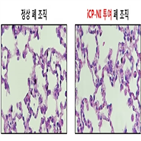 고농도,코로나19,안전성,투여