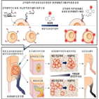 전구세포,혈관내피,허혈성,치료,치료제,개발