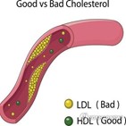 콜레스테롤,감염,코로나19