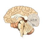 뇌졸중,위험,연구팀,사실,연구