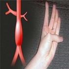 대동맥,엄지,테스트,손바닥