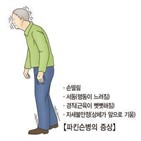 파킨슨병,환자,연구