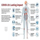 코로나19,알츠하이머병,신종,코로나,논문,연구