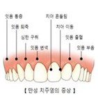 치주염,질환,심뇌혈관