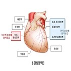 관상동맥,질환,연구팀,결과