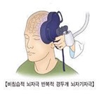 우울증,연구팀,자기자극,부위,치료