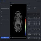 영상,뉴로핏,분석,진단,솔루션