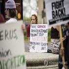 미시간주,낙태,판결,권리,연방대법원,금지