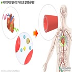 운동,그룹,당뇨병,심혈관질환,발생,지속적