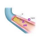 당뇨병,시작,혈중,수치