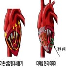 부정맥,전기,자극,치료,심장,발생