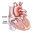 도자,심방세동,절제술,전극,인지기능,그룹