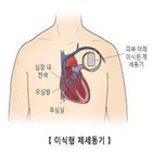 제세동기,환자,불안장애