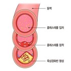 리포솜,혈관,연구팀,개발,투여