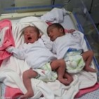 가자지구,쌍둥이,이스라엘,병원