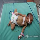 병원,가자지구,연료,아기,공급,상황,팔레스타인
