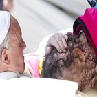 교황,리바,사람,신경섬유종,얼굴
