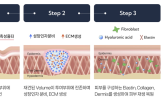 이드,재생치료제,기술,대한,기반,임상시험,다양,환자,임상