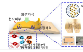 전자피부,자가,치유,개발,손상