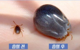 진드기,야외활동,증상