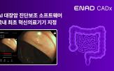내시경,검사,대장암,진단,아이넥스
