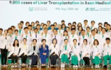 간이식,수술,서울아산병원