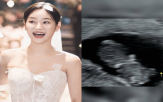 유나,강정훈